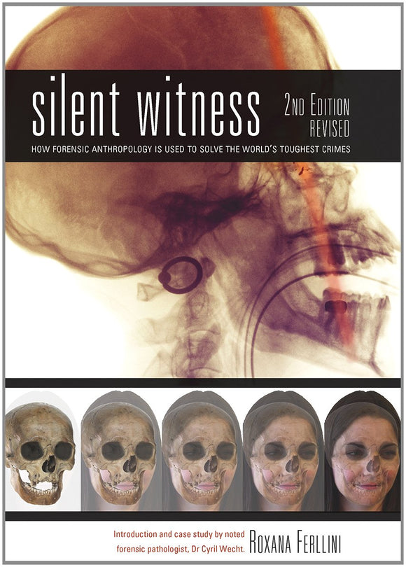 Silent Witness, How Forensic Anthropology Is Used To Solve The World's Toughest Crimes; Roxana Ferllini